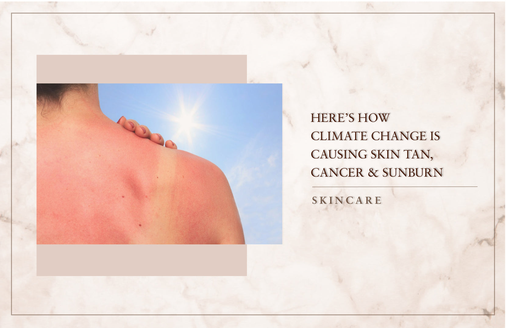 Here’s How Climate Change Is Causing Skin Tan, Cancer & Sunburn