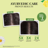 Thumbnail for Anti Dandruff Shampoo | Lemon, Bhringraj & 12 Herbs