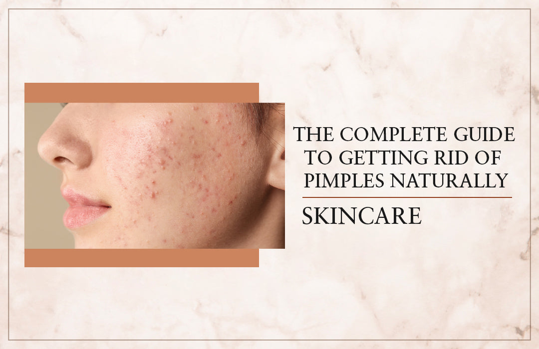 The Complete Guide To Getting Rid Of Pimples Naturally