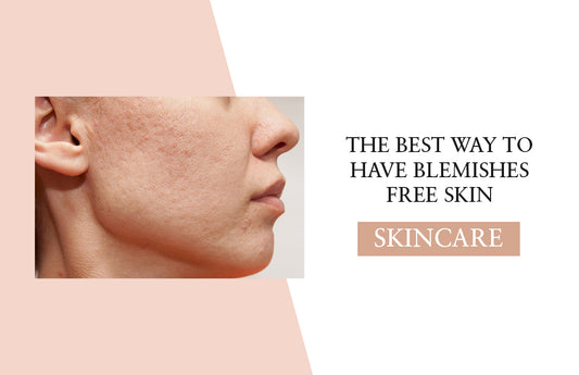 The Best Way To Have Blemishes Free Skin