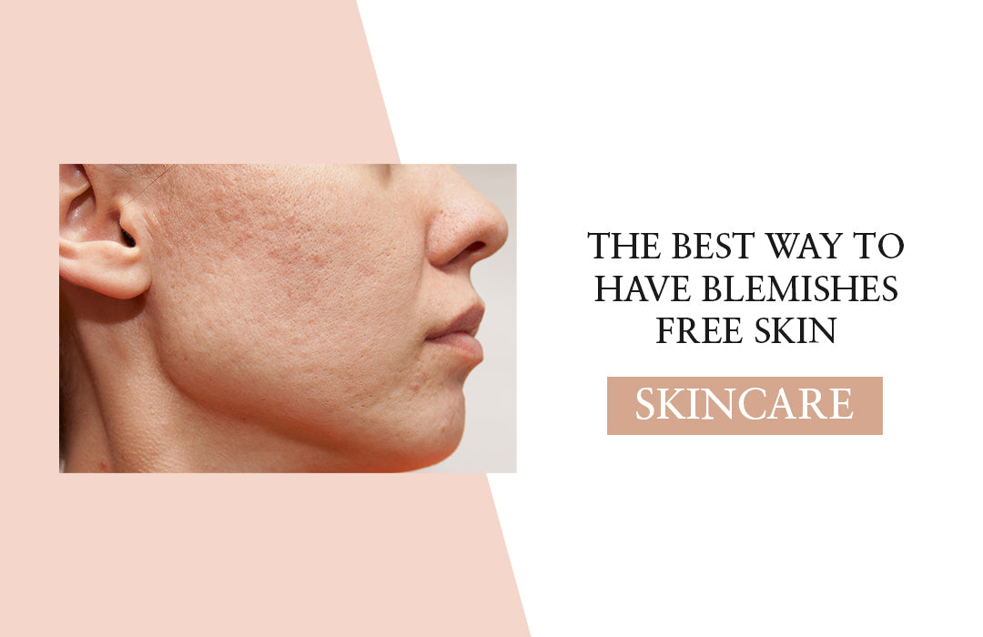 The Best Way To Have Blemishes Free Skin