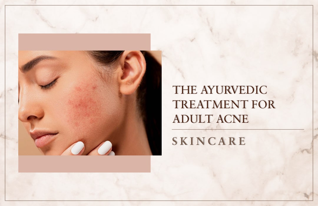 The Ayurvedic Treatment For Adult Acne
